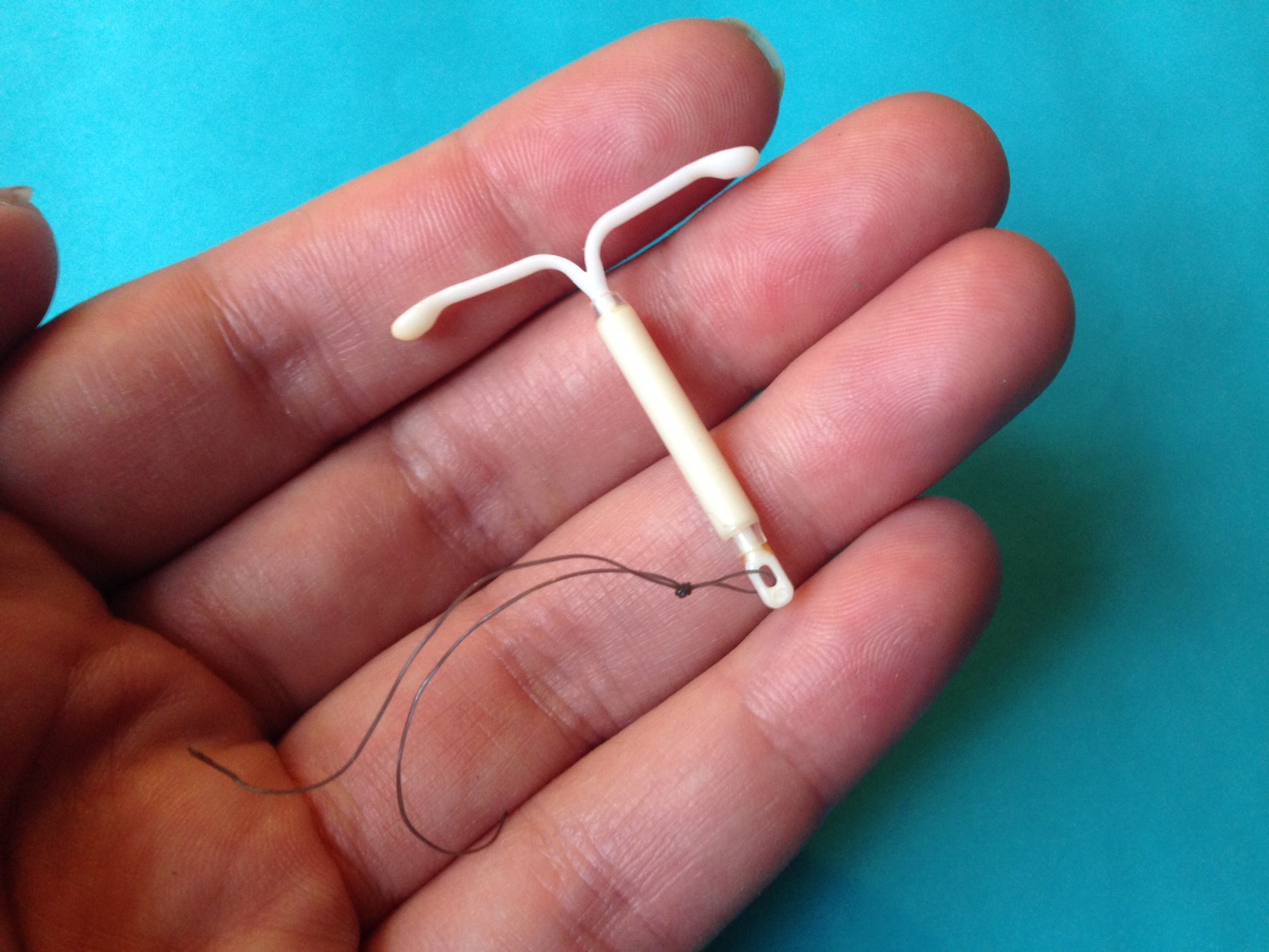 IUD IUS Removal